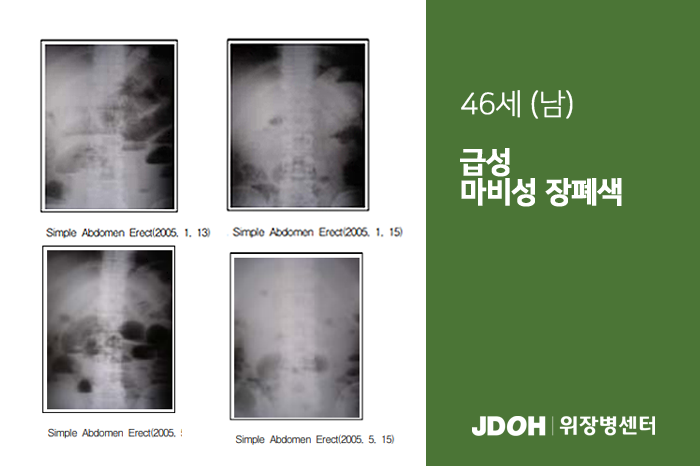 수술후기 이미지