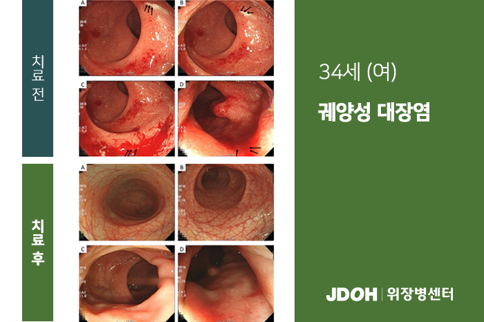 수술후기 이미지