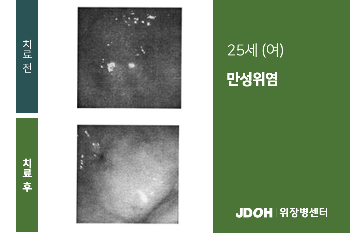 수술후기 이미지