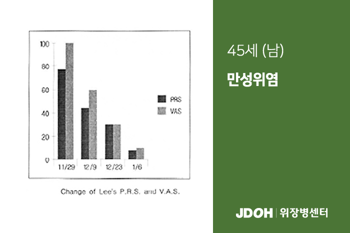 수술후기 이미지