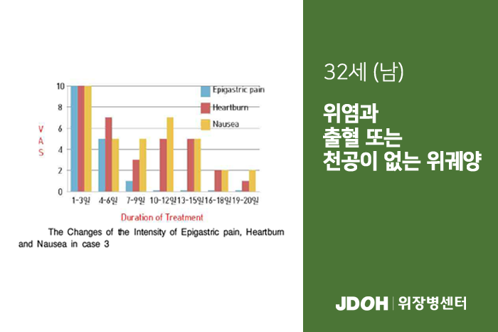 수술후기 이미지