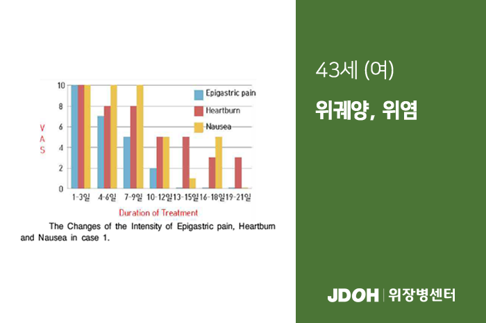 수술후기 이미지